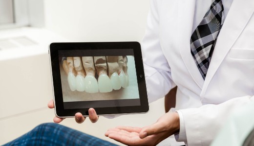 The Benefits of Sedation Dentistry, Toronto Dentist